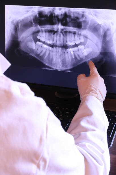 Best Emergency Dentist for Knocked-Out Tooth in Chicago Ridge, IL